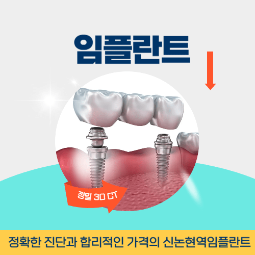 춘천치과 춘천시 치과 임플란트