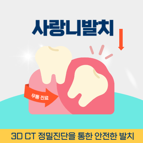 춘천치과 춘천시 치과 사랑니 발치